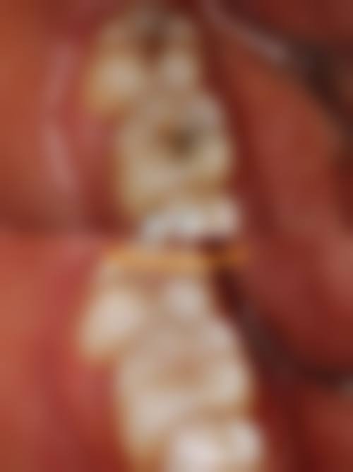 七、玉林一诺口腔门诊部就医指南,便捷就诊不迷路