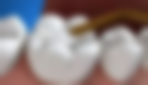 五、深圳颐齿口腔诊所舒适就医环境,打造人性化诊疗体验