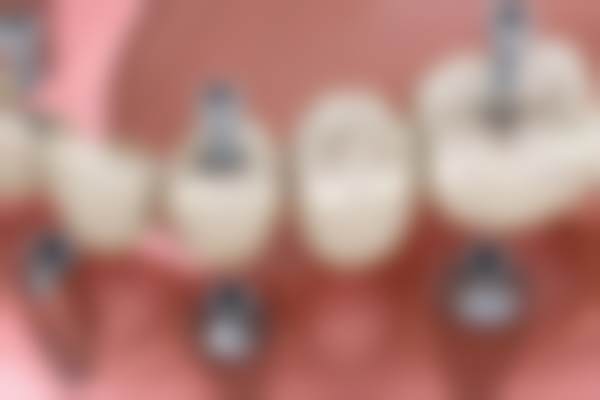 三、镇江京口博雅口腔诊所核心科室与特色项目