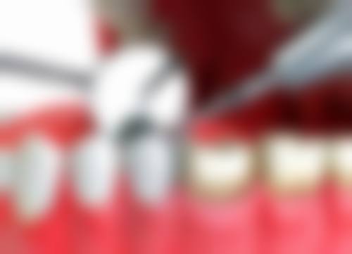 四、江苏盐城东台卫华口腔门诊部设备介绍