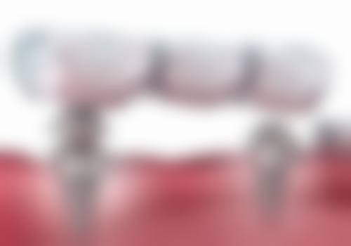 七、湖南永州牙博士口腔医院就医指南,便捷就诊不迷路