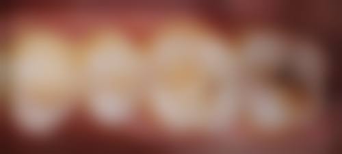 五、湖南郴州佳美口腔舒适就医环境，打造人性化诊疗体验