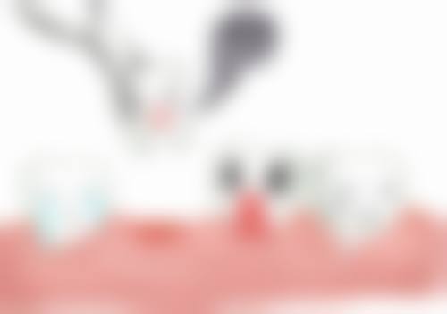 二、广东东莞凤岗玉冰口腔医生团队,打造专精诊疗服务