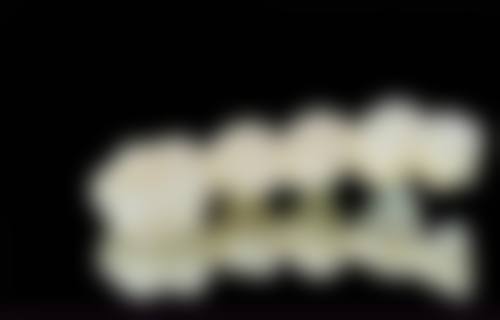 四、泰安洪元口腔门诊部设备介绍