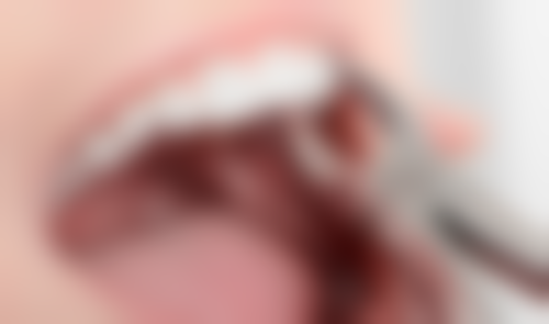 七、广州团圆口腔门诊就医指南，便捷就诊不迷路