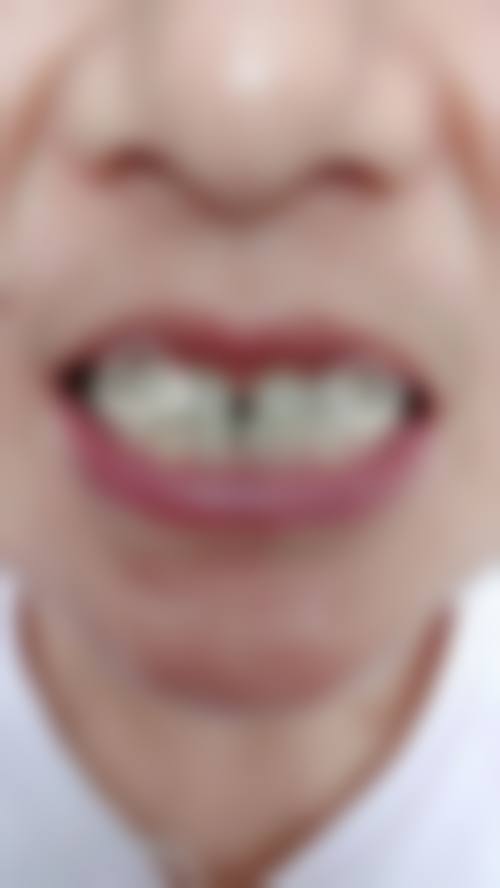 七、广东惠州东诚口腔就医指南，便捷就诊不迷路