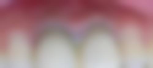 五、陕西榆林市榆阳区亿口笑口腔舒适就医环境，打造人性化诊疗体验