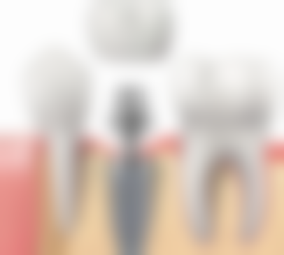 三、陕西榆林市榆阳区亿口笑口腔核心科室与特色项目