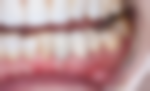 四、中山市人民医院口腔修复科设备介绍