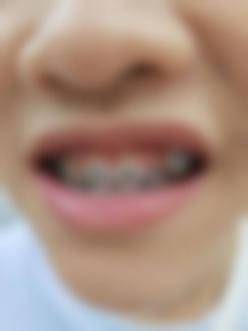 三、莆田涵江好牙依口腔核心科室与特色项目