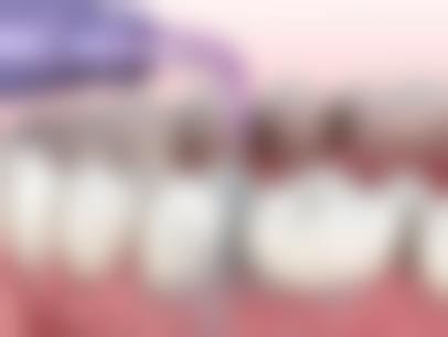 二、深圳胡婷口腔诊所医生团队，打造专精诊疗服务