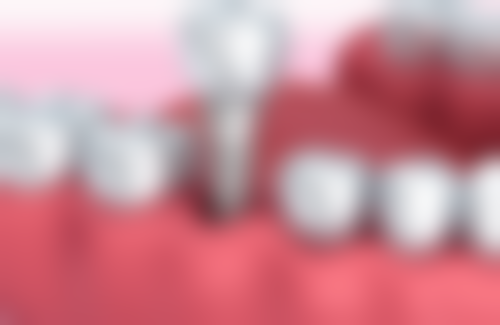 七、昆明玉川口腔医院就医指南，便捷就诊不迷路