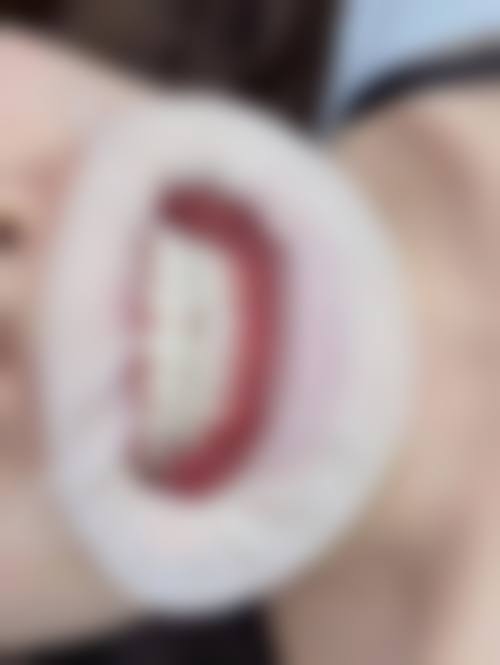 六、西安沐森植发医疗诊所荣誉资质与患者口碑，见证品牌实力