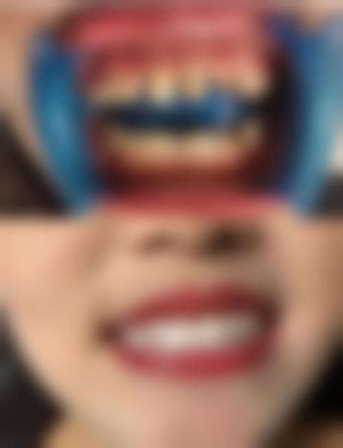 四、西安沐森植发医疗诊所设备介绍