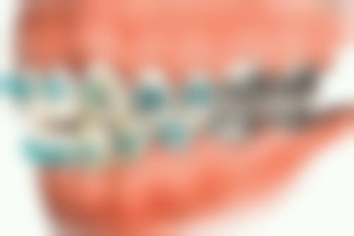 七、阳泉皓瑞齿科口腔诊所就医指南，便捷就诊不迷路