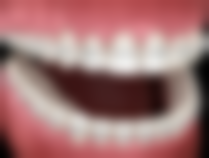 四、阳泉皓瑞齿科口腔诊所设备介绍