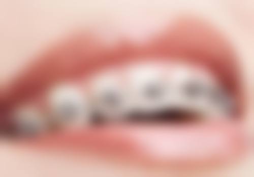 四、保山施甸博圣口腔(荷池店)设备介绍