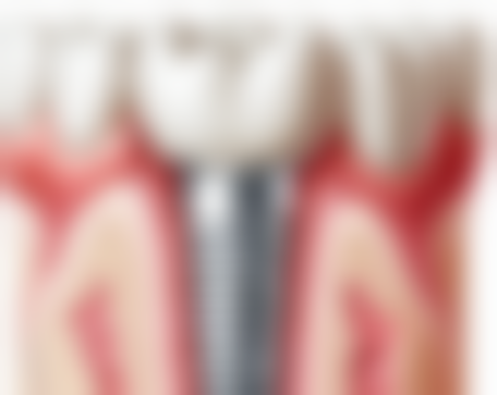 六、广东东莞谢岗韩亚口腔荣誉资质与患者口碑，见证品牌实力