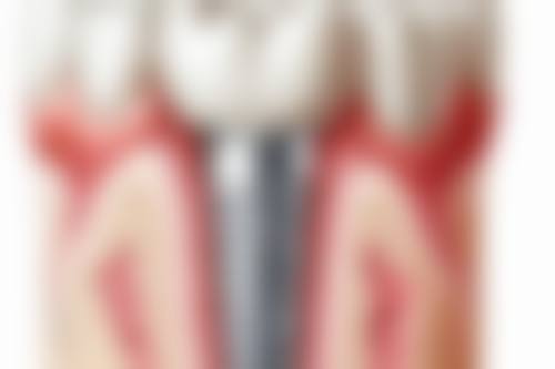 六、深圳嘉尔口腔诊所荣誉资质与患者口碑，见证品牌实力