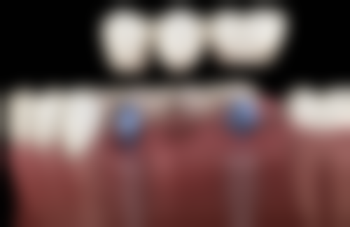 五、湖州善美口腔舒适就医环境，打造人性化诊疗体验