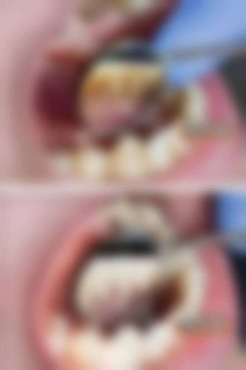 二、泰安市泰山区一加口腔诊所医生团队,打造专精诊疗服务