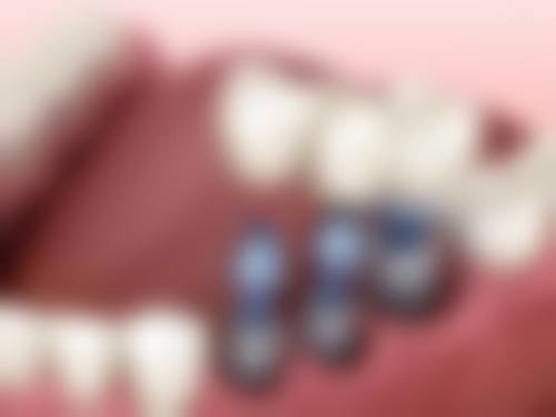 五、吴忠红寺堡区众合口腔舒适就医环境，打造人性化诊疗体验