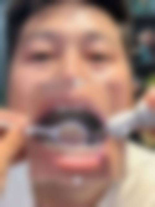擅长项目详解深圳刚翰口腔门诊部钱付民