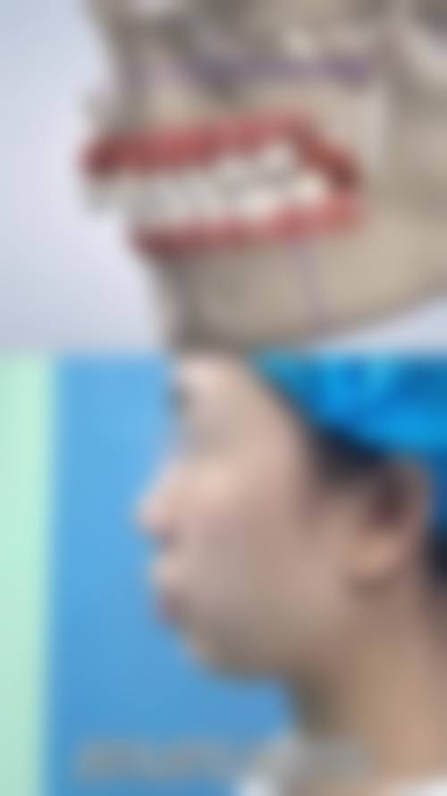 患者真实评价深圳刚翰口腔门诊部钱付民