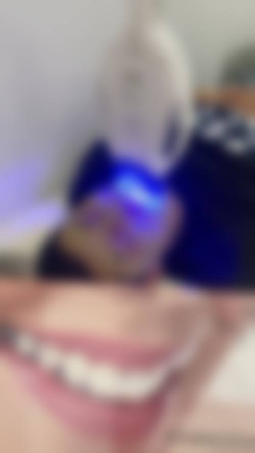 擅长项目详解深圳美奥口腔医院杨忠
