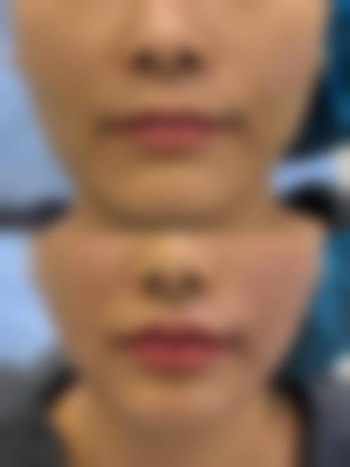 预约优惠活动