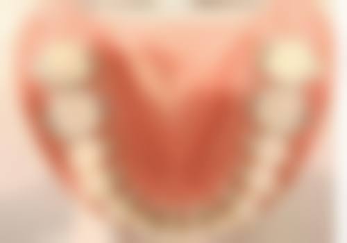 结语:专精守护微笑,即刻预约享优惠
