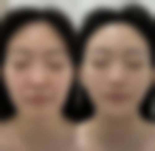 FAQ徐州懿薇莱美容李志敏