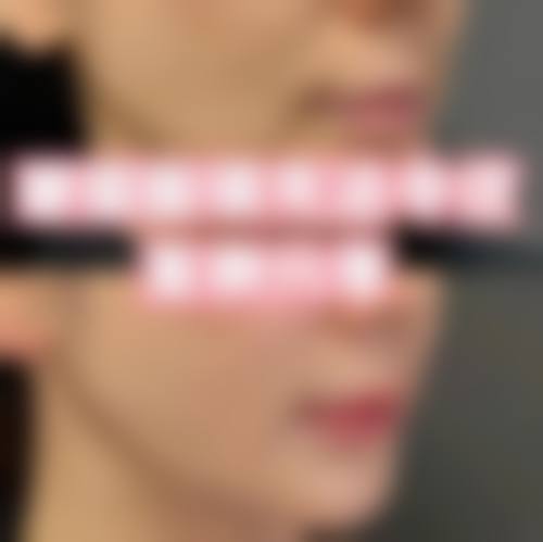 患者真实评价徐州懿薇莱美容李志敏