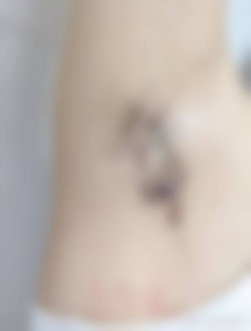 优惠活动详情:透明价格与预约指南