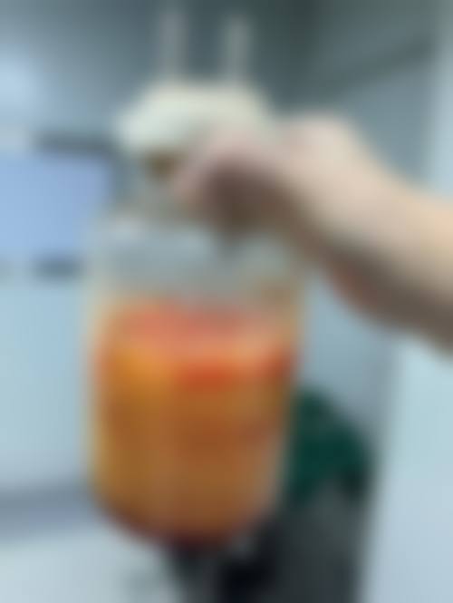 擅长项目详解:范传峰+泰安爱尔光明医院+核心项目