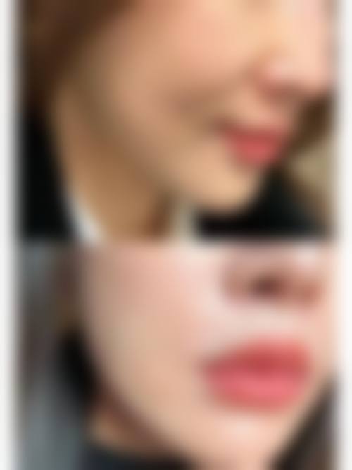 医生资质介绍徐州懿薇莱美容李志敏