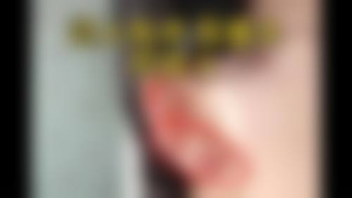 患者真实评价:范传峰+泰安爱尔光明医院+核心项目