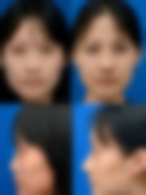 临床实例分享：真实反馈见证成效