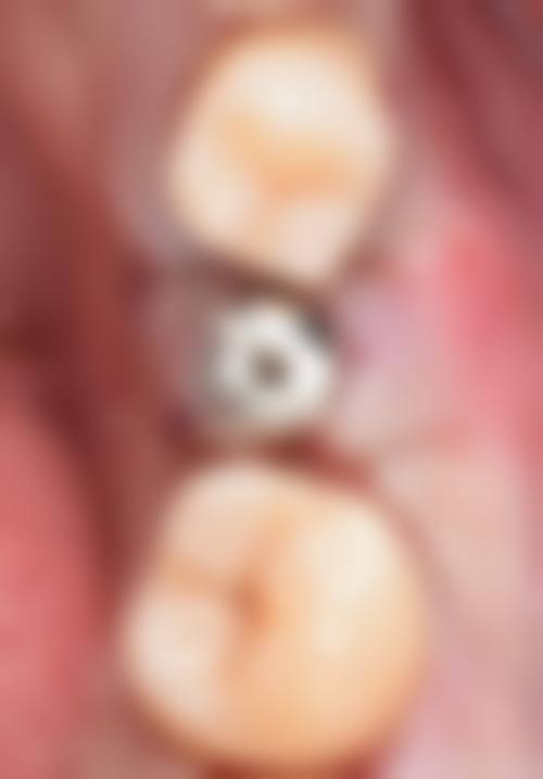 临床实例分享