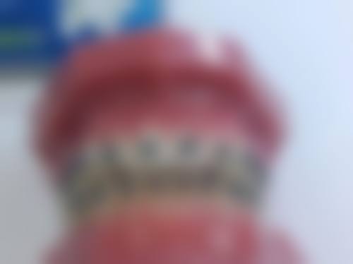 预约优惠活动
