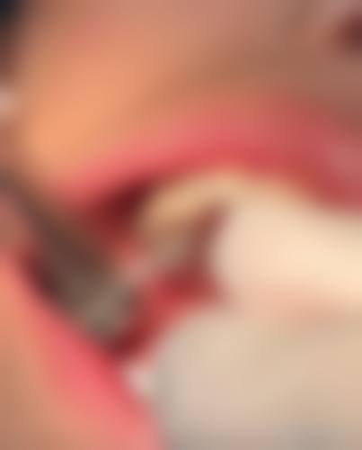 预约优惠活动：石家庄玉生口腔门诊部耿玉生