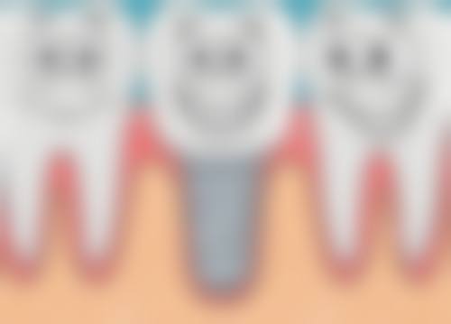 擅长项目详解