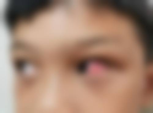 结尾预约号召:立即行动,重拾清晰视界