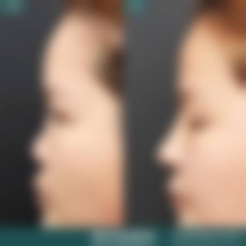 临床实例分享