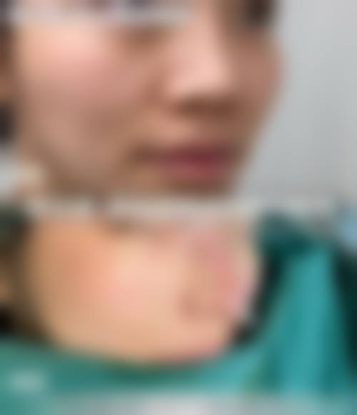 预约优惠活动