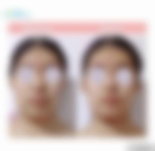 患者真实评价