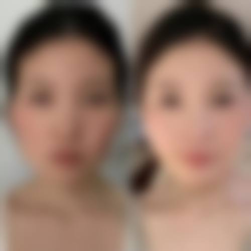 临床实例分享