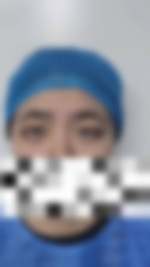 擅长项目详解
