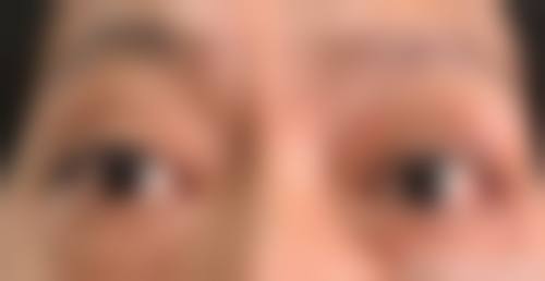 临床实例分享