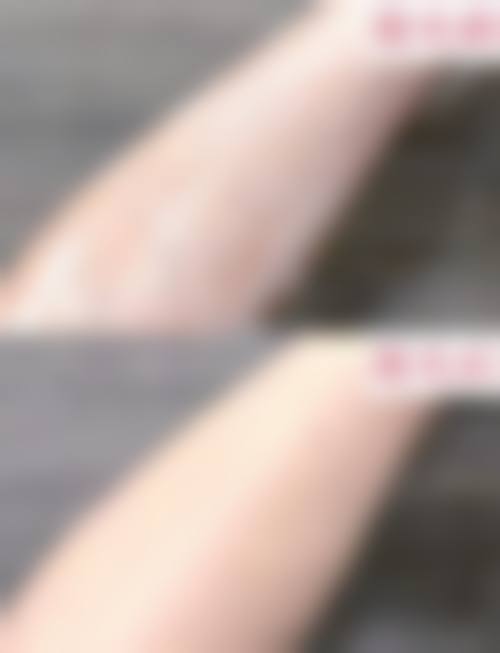 临床实例分享：真实反馈见证实力